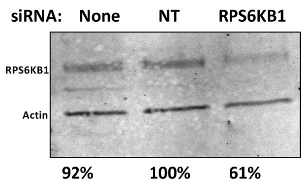 Detection of RPS6KB1 using Western blot analysis.jpg